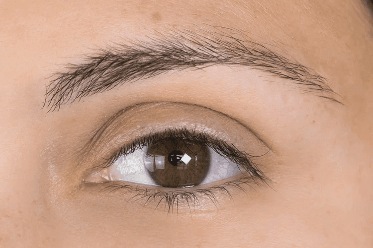 Before lash set